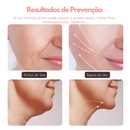 Massageador Facial Led Aparelho Tratamento Com Luz Fototerapia Lift Usb